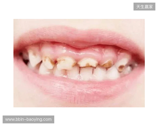 韦林顿确诊上唇部贯通伤；11、21牙半脱位；上颌前牙区牙槽骨骨折